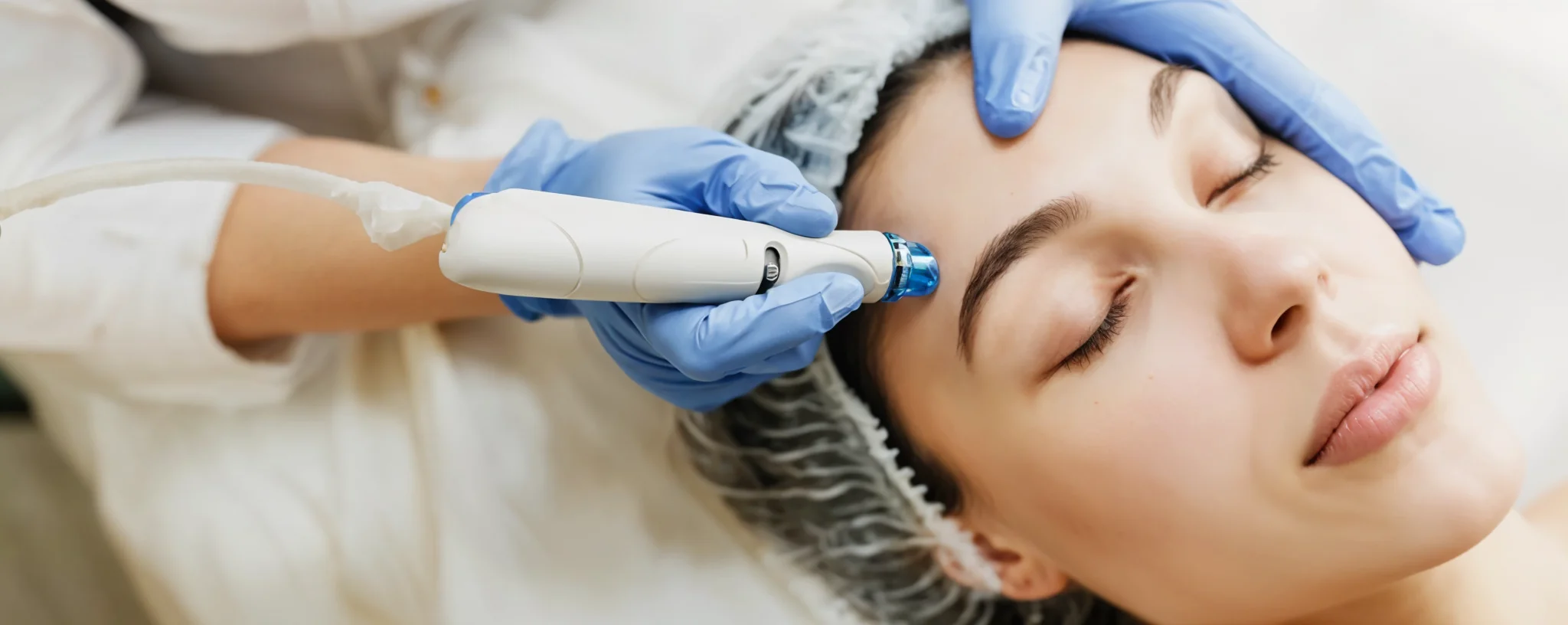 Jak działa radiofrekwencja mikroigłowa i&nbsp;kiedy warto ją&nbsp;wybrać?