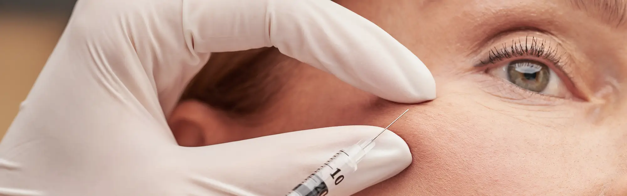 Toksyna botulinowa czy&nbsp;kwas hialuronowy – jaki zabieg wybrać