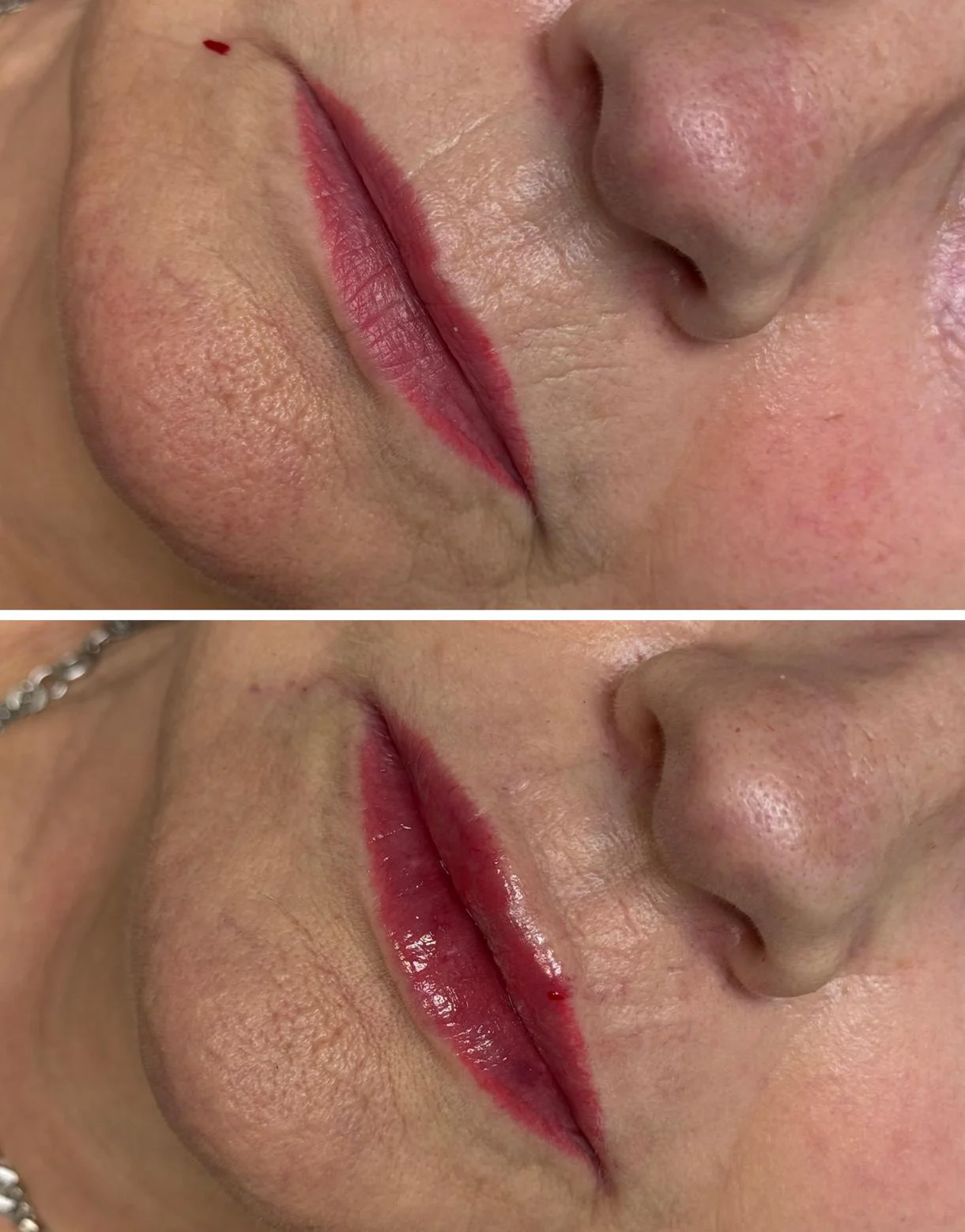 Powiększanie i modelowanie ust